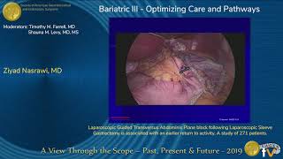 How to Correctly Identify Anatomy for Transversus Abdominis Plane TAP Block [upl. by Manfred]