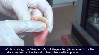 Using Simplex Rapid Acrylic to repair a denture [upl. by Jake]