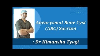 Aneurysmal Bone Cyst ABC Sacrum Treatment  Surgery  What is an Aneurysmal Bone Cyst [upl. by Daryl]