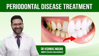 Periodontal Disease Treatment  GUM Disease  What is the Best Treatment for Periodontal Disease [upl. by Ag824]