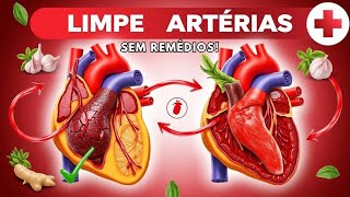 LIMPE AS ARTÉRIAS ENTUPIDAS NATURALMENTE SEM REMÉDIOS E SEM CIRURGIA [upl. by Blackwell]