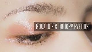 How to Fix Droopy Eyelids [upl. by Laamaj418]