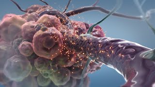 How Superselective IntraArterial Infusion Works for Treating Glioblastoma  Ivy Brain Tumor Center [upl. by Inattirb304]