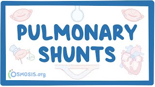 Pulmonary shunts [upl. by Clemmie]