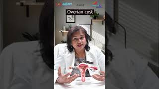 Ovarian Cyst Symptoms You Should Never Ignore [upl. by Ydualc]