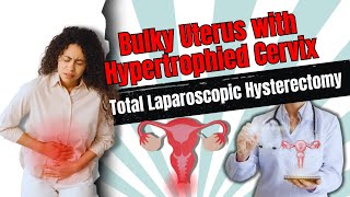 TLH BSO  Bulky Uterus with Hypertrophied Cervix ipd No 1119849  Dr Gyanendra Man Singh Karki [upl. by Aliet710]