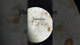 Trichuris trichiura biología science musica [upl. by Beaston]