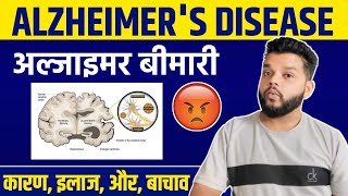 Alzheimers Disease In Hindi  Alzheimers Disease SymptomsCauses amp Treatment [upl. by Cooper]