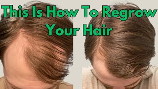 This Is What You Should Try If You Want To Regrow Your Hair And Start Fighting Your Hair Loss [upl. by Pattison]