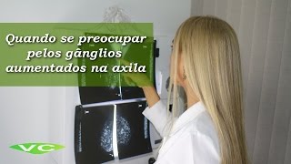 Gânglios na Axila ⚠️ ALERTA ⚠️ Quando deve se PREOCUPAR  Dra Vanderlea Coelho ®️ Câncer de Mama [upl. by Alaham]