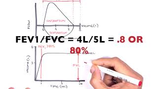 Understanding Spirometry  Normal Obstructive vs Restrictive [upl. by Namajneb]