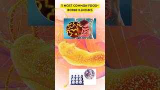 5 Most Common Foodborne Illnesses and Which Bacteria Cause Them [upl. by Acisej]