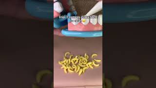 Dentist’s from Temu be like asmr asmrvideos satisfying [upl. by Pollak]