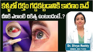 ఇంజక్షన్ తో కంటి చికిత్స  Diabetic Retinopathy Eye Injection Procedure  Best Vision Eye Hospital [upl. by Frangos]