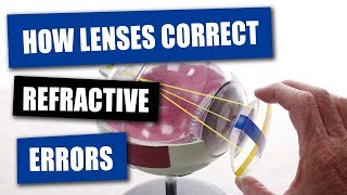 How Opticians Use Lenses To Correct Refractive Errors [upl. by Adnohsek249]