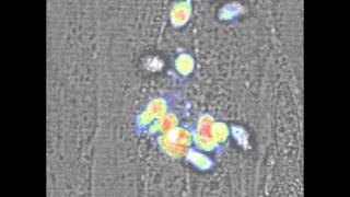 Toxoplasma parasites busting out of their human host cells [upl. by Noonan]