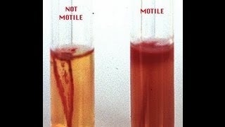 Motility Determination in Bacteria  Amrita University [upl. by Diamante785]