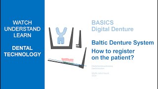 Baltic Denture System  How to register on the patient [upl. by Forward]