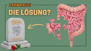 Den Darm entfernen lassen  Die Lösung bei Colitis Ulcerosa  Morbus Crohn Meine Meinung [upl. by Punke196]