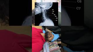 🌱🌿CHIROPRACTIC TREATMENT IN VIZAG 🌿🌱 8500371020 chiroprac chiropractor shorts backpain [upl. by Cathe612]