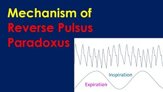 Mechanism of Reverse Pulsus Paradoxus [upl. by Ozen43]