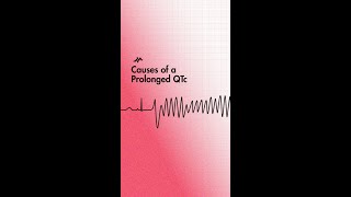 Causes of QT Interval Prolongation [upl. by Nnairak904]