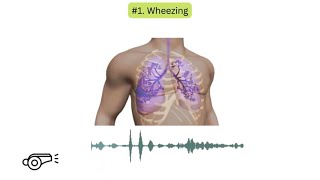 Abnormal lung sounds in COPD [upl. by Kcyrred695]