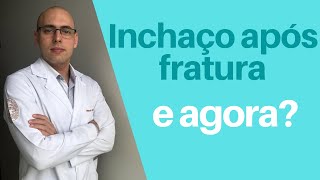 INCHAÇO APÓS FRATURA CIRURGIA OU GESSO  O que fazer É normal [upl. by Dorrehs]