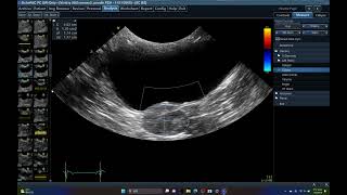 5565 CRYPTORCHIDISM  ECHOPAC ANALYSIS HIDDEN TESTIS ABDOMINAL ULTRASOUND DOG [upl. by Thalia]