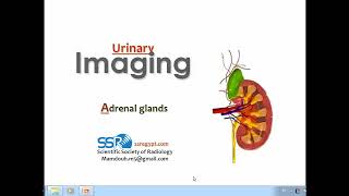 Imaging of Adrenal glands DRE Prof Mamdouh Mahfouz [upl. by Ambrosius]