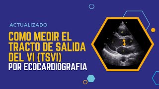 📏Cómo medir el 🎯TRACTO DE SALIDA DEL VENTRÍCULO IZQUIERDO TSVI por ecocardiografía Actualizado [upl. by Anyalram529]