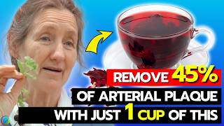 Clear CLOGGED ARTERIES Instantly  Barbara Oneill Reveals The 1 SOLUTION To Change Your Life [upl. by Stout]