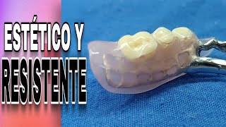 PRÓTESIS DENTAL HÍBRIDO PASO A PASO  Flexible y Metal [upl. by Aelc]