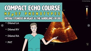 〖Echocardiography〗 HFpEF amp mitral stenosis amp DD Guidelines 💜 [upl. by Zachery]