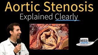 Aortic Stenosis Explained Clearly  Diagnosis and Treatment [upl. by Pass]