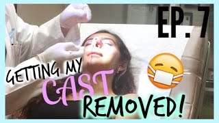 Rhinoplasty at 16 Vlog CAST REMOVAL DAY Episode 7 [upl. by Sirraf]