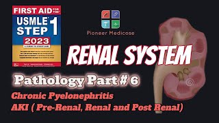 Acute Kidney Injury and Chronic Pyelonephritis for USMLE step 1pathology Part 6UrduHindi [upl. by Zailer]