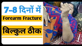 forearm fracture physical therapy exercises radius ulnar fracture wrist surgery recovery exercises [upl. by Adnirak276]