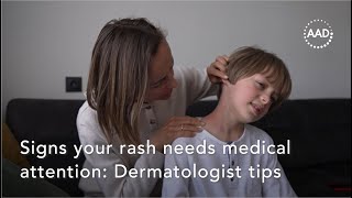 Signs your rash needs medical attention Dermatologist tips [upl. by Anaehs176]