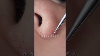 immersive skin care strawberry nose blackhead deep pore cleaning skin management [upl. by Aba]