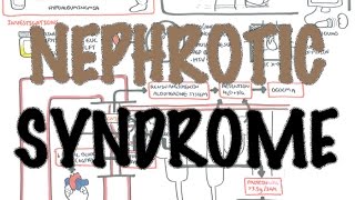 Nephrotic Syndrome  Overview Sign and symptoms pathophysiology [upl. by Leid940]