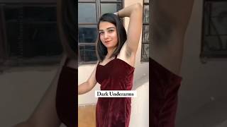 Dark Underarms Cleaning Tips underarmscleaning darkunderarmscleaning underarms skincare shorts [upl. by Reh989]