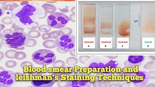 Blood smear Preparation l Leishmans Staining Techniques l Leishmans Staining Procedure ln Odia l [upl. by Pfeifer8]