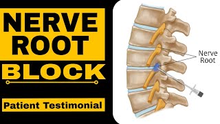 Nerve Root Block Patient Testimonial [upl. by Lorrie]