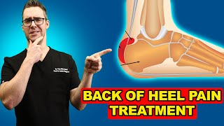 Retrocalcaneal Heel BURSITIS Treatment Heel Pain Exercises amp Massage [upl. by Yelsnia]