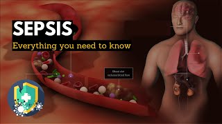 Sepsis Everything You Need to Know [upl. by Gerc739]