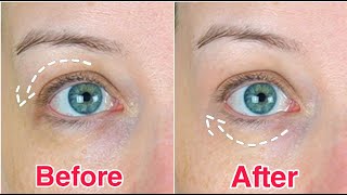 10 SECOND FIX FOR DOWNTURNED EYES with 1 Product [upl. by Zashin]