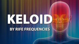 Keloid  RIFE Frequencies Treatment  Online Sound Therapy  Positive Energy Healing  Meditation [upl. by Leahcimauhsoj]