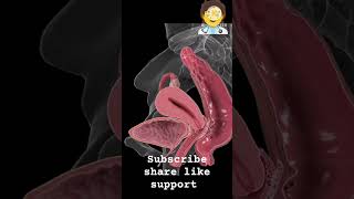 endometriosis shortsfeed youtubeshorts shorts [upl. by Ignatius]