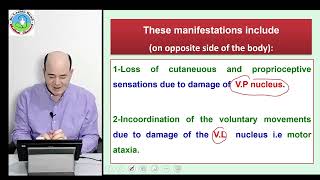 Thalamic syndrome [upl. by Ivana930]